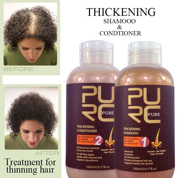 Best Hair Loss Products
