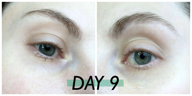 17+ Eyebrow Growth Castor Oil For Eyebrows Before And After Pictures Gif